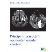 Principii si practica accidentul vascular cerebral